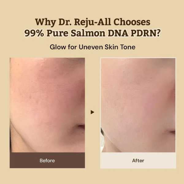 Dr. Reju-All – Advanced PDRN Rejuvenating Cream 20ml