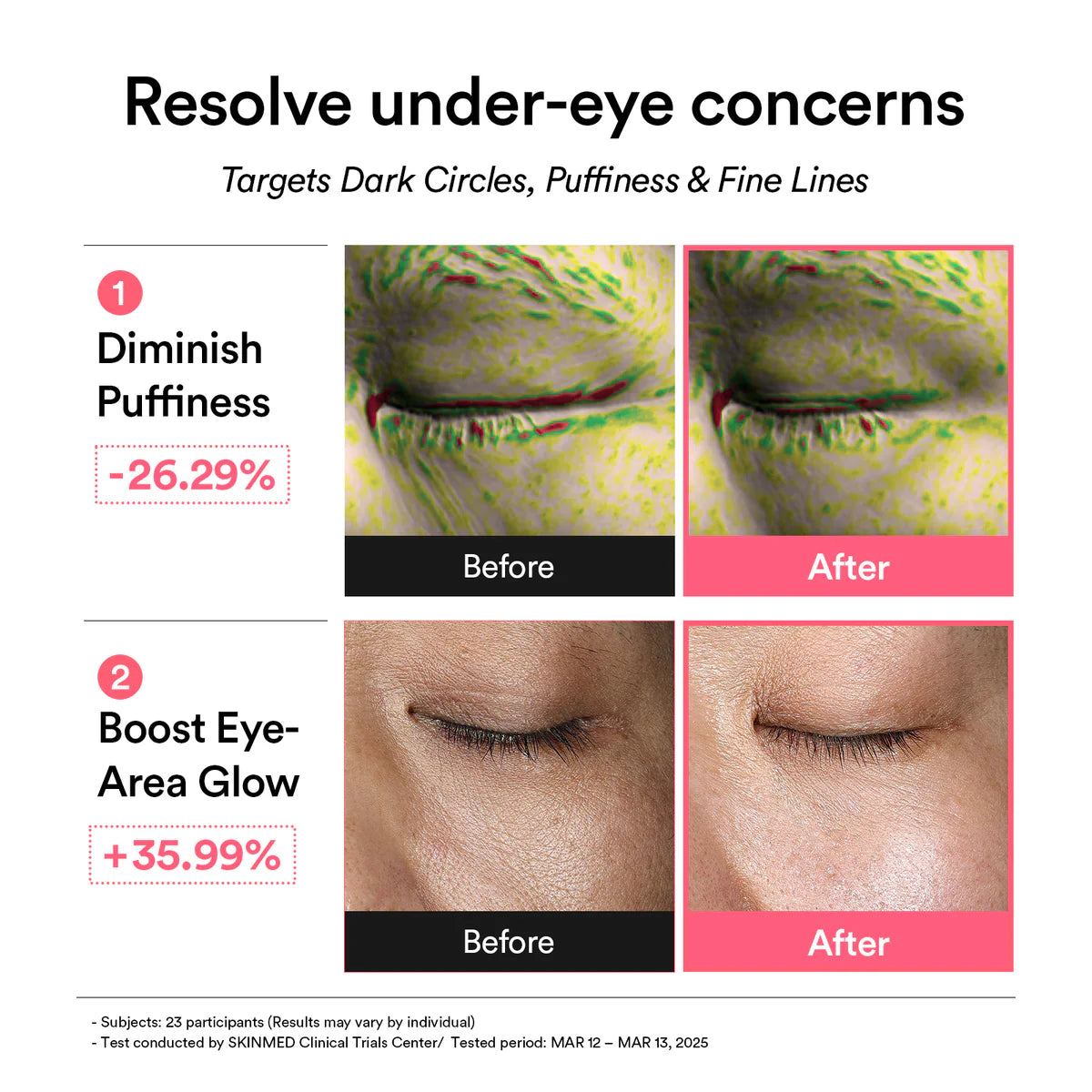 ABIB – PDRN Retinal Eye Patch Glow Jelly 84g
