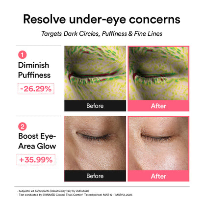 ABIB – PDRN Retinal Eye Patch Glow Jelly 84g