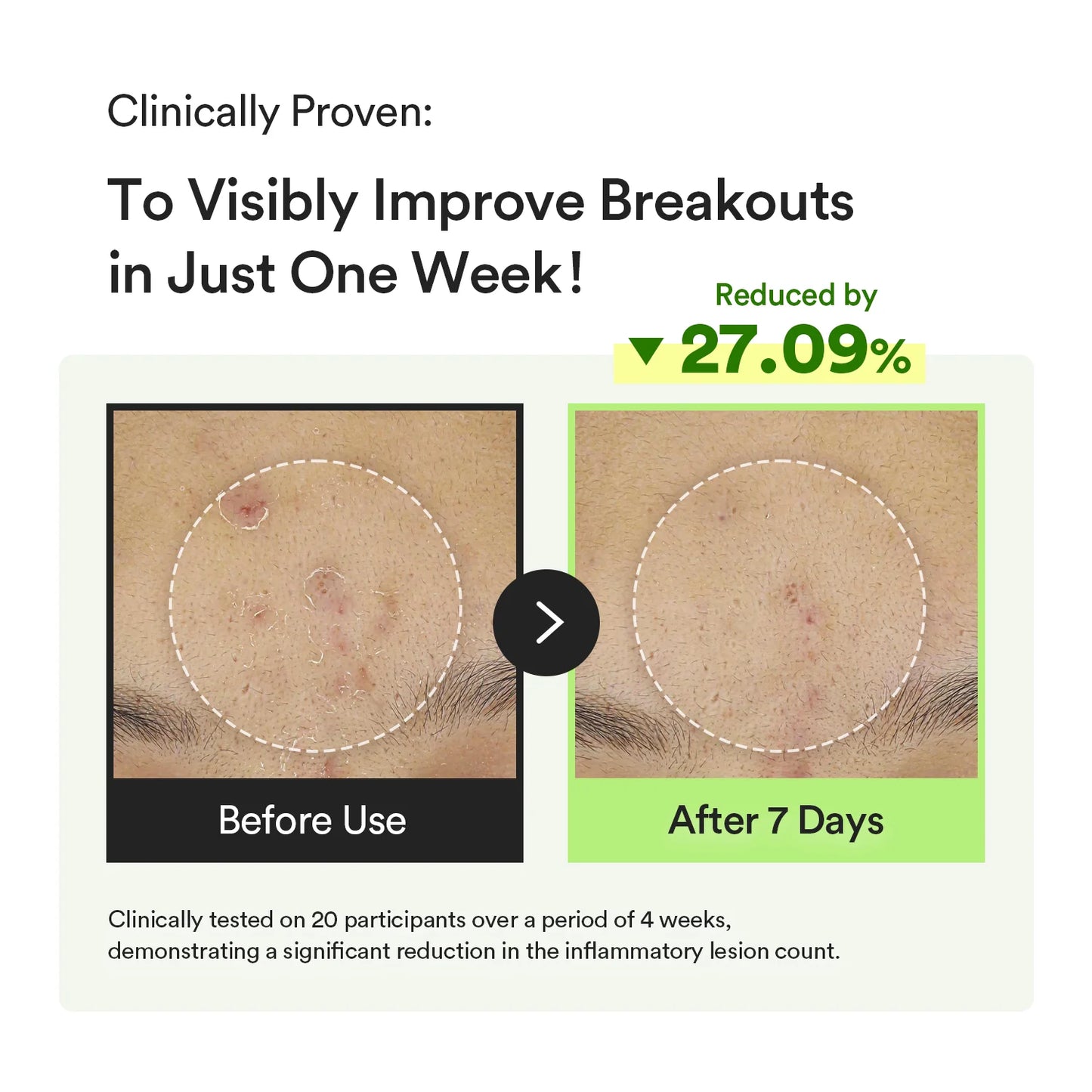 ABIB – Heartleaf TECA Capsule Serum Calming Drop, 50ml