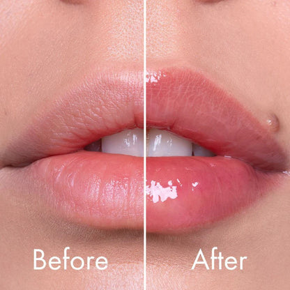 VT Cosmetics – Reedle Shot Lip Plumper Expert 4.3g