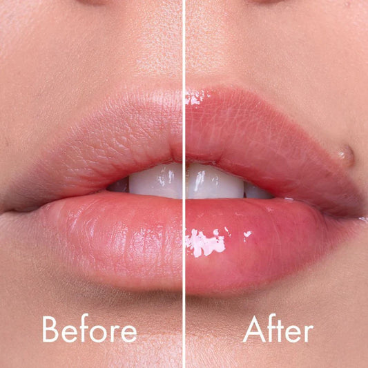 VT Cosmetics – Reedle Shot Lip Plumper Expert 4.3g